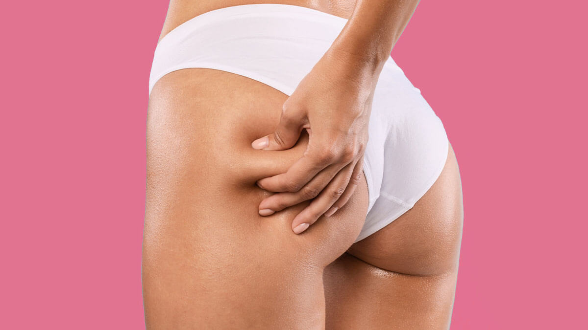 A close-up image of a woman pinching her thigh to show cellulite, wearing white underwear, set against a pink background.