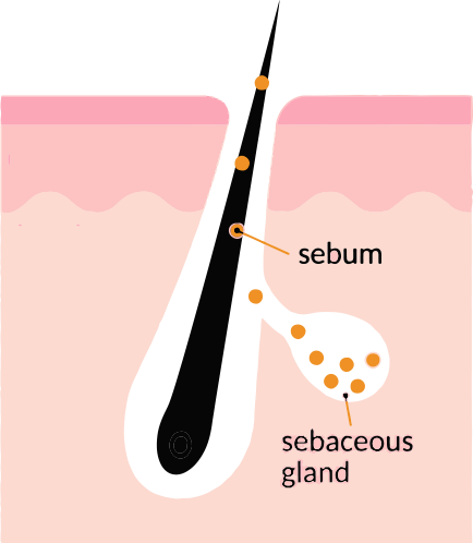 Diagram showing a hair follicle embedded in the skin with the sebaceous gland producing sebum, indicated by labeled arrows.