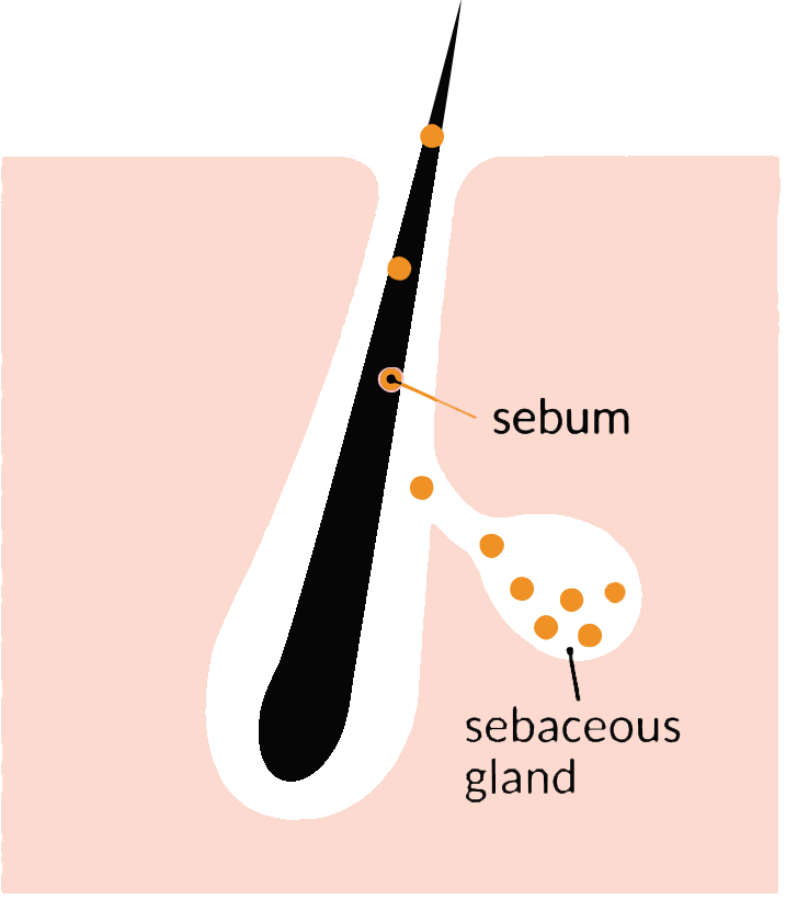 Diagram showing a cross-section of skin with a focus on a hair follicle and sebaceous gland, detailing the production and flow of sebum.