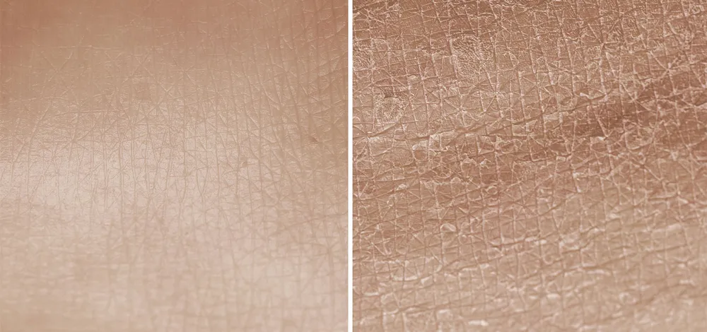 Close-up of two adjacent skin textures. The left side shows smoother, hydrated skin with fewer lines. The right side shows drier, rougher skin with more pronounced lines and a cracked appearance. The comparison highlights the difference between moisturized and dry skin.